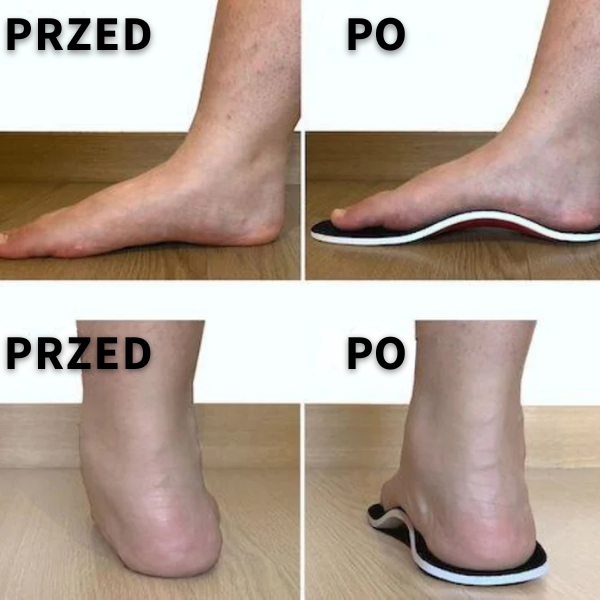 Profilierte orthopädische Schuheinlagen - Centrum Ulgi